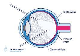 Siatkówka oka jest przezroczystą, cienką błoną, która wyściela wnętrze gałki ocznej. Witrektomia Oka Warszawa Odklejenie Odwarstwienie Siatkowki Operacja Cena Zacma Po Witrektomii
