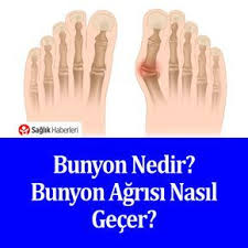 Bunyon Agrisi Nasil Gecer Saglik Recete Refleksoloji
