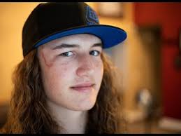 Syracuse teen Cole Cheney continues recovery from horrific dirt bike  accident