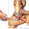 Tendons and ligaments of the leg. 1