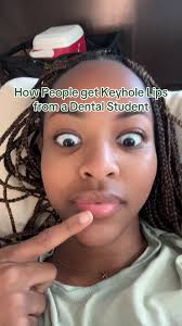 Understanding Keyhole Lips: A Dental Student's Insight