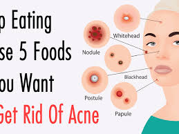 Single taxpayers will receive the. 5 Foods To Never Eat If You Have Acne