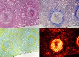 Diabetes can drive the evolution of antibiotic resistance Labmate Online