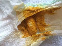 fotograflarla bebek kakasi turleri ve anlamlari bebekveben