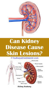 Watch your cat carefully for symptoms. Pin On Kidney Disease Diet
