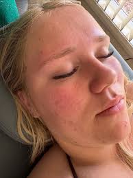 Models needed for content purposes 1X Brow Wax with Tint ( Free) 1X Lash  lift with Tint £27 1X Brow Lamination £22 Pics below are of my own work 🥰  Simply comment