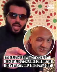 😬 Tyson Fury did not want this to come out 🚨 The secret was revealed  against his wishes