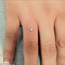 Trend Sees Women Ditch Wedding Rings For Very Painful Finger Piercings Finger Piercing Piercings Dermal Piercing