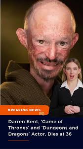 Got Actor Kent Daniel Dies