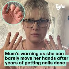 Lisa says her nails just started peeling away 😮