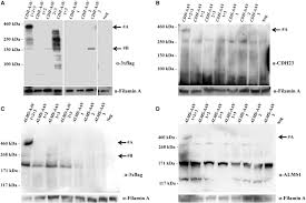 Image result for Black 1997 AAV