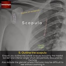 Image May Contain Text Emergency Department Radiologist Radiography