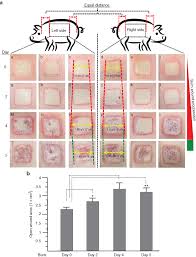 All solutions pest control is locally owned and operated. Dual Therapeutic Functions Of F 5 Fragment In Burn Wounds Preventing Wound Progression And Promoting Wound Healing In Pigs Molecular Therapy Methods Clinical Development