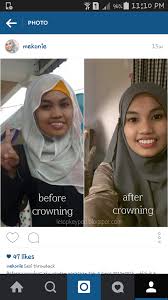 Klinik pergigian zahida has been providing quality dental care in section 8 shah alam for more than 12 years. Kisah Ke Klinik Pergigian Qisya Puncak Alam Mek Onie