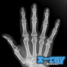 How to xray photos android. X Ray Scanner Home Facebook