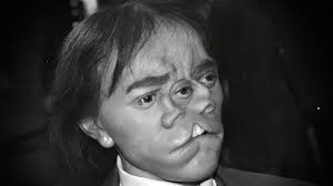 20 Unbelievable World Records Even Doctors Can't Explain!