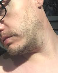 But the real problem may not be lack of growth, but lack of time. 35 Yearold Male Facial Hair Getting Thicker Finally Should I Attempt Growing This Out I Have A Date Tonight Beard Board