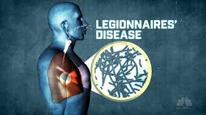 Older adults, smokers and people with weakened immune systems are particularly susceptible to legionnaires. Baby S Death After Contracting Legionnaires Disease In Hospital Highlights Risks