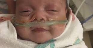 One of world's tiniest babies goes home from Kaiser Permanente Fontana  Medical Center