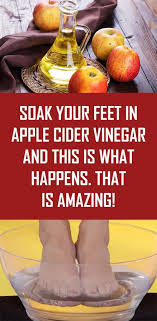 Soak Your Feet In Apple Cider Vinegar And This Is What Happens That Is Amazing Apple Cider Vinegar Raw Apple Cider Vinegar Healthy