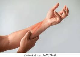Image result for Skin Trauma
