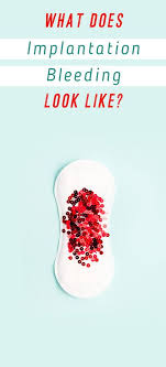 Implantation Bleeding When It Happens And How It Look Like Pregnancy Tips Pregnancy Pregnancy Tips Parenting