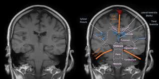 Radiology Basics Head Anatomy