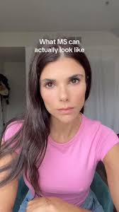 did any of these surprise you? , This is what MS can actually look like and  it’s probably not what you’re picturing, ., ., ., #multiplesclerosis  #chronicillness