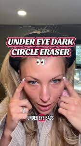 Effective Under Eye Brightener for Dark Circles