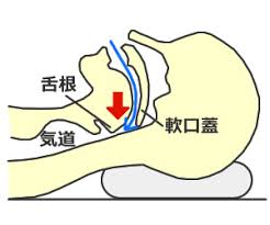 「肥満」の画像検索結果