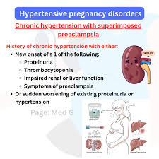 Image result for Mild PIH Management