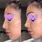 Shopping doctors for rhinoplasty, looking for insight. My top 4 picks are  ashkan ghavami, rod Rohrich, William Portuese, spencer cochran. Any Recs?  looking anywhere in U.S. this is my desired outcome : r/PlasticSurgery