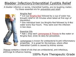 Pin On Young Living Essential Oils