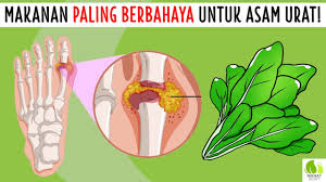 Makanan yang harus dielakkan oleh penghidap gout. Senarai Makanan Untuk Dihindari Oleh Pesakit Gout