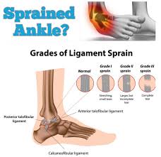 Maybe you would like to learn more about one of these? Sprained Ankles Here S What Happens Ankle Sprain Recovery Sprain Ankle Tendonitis