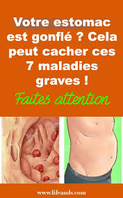 Votre Ventre Est Il Enfle Il Peut Cacher Ces 7 Maladies Graves Notez S Il Vous Plait Esprit Sante En 2021 Estomac Conseils Dietetiques Sante