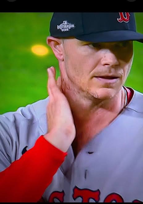 Can someone please explain to me why Sonny Gray has been touching his neck  this entire game?!?!? Obviously it looks like something is on his neck, A  lot of people are saying