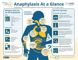 Image result for Anaphylaxis