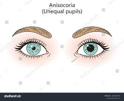 Image result for Anisocycla