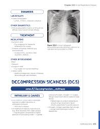Image result for Decompression Sickness Management