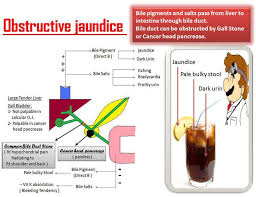 Pin On Medicine Helpful Medical Diagrams