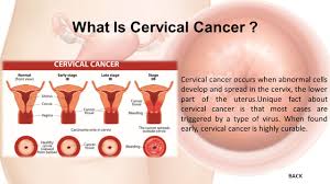 Your doctor will talk with you about side effects you may have based on your treatment (s): Sexually Active Women Should Be Screened Regularly For Hpv Truth For Its Own Sake