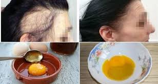 Hint Yaginin Faydalari Nelerdir Hint Yagi Kas Ve Kirpik Icin Kullanilir Mi Cilt Bakimi Hair Growth Faster Hair Growth Treatment Hair Remedies For Growth