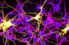 Image result for brain cell