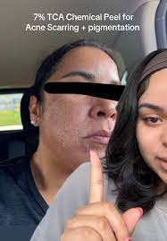 Best Korean Facial in Philadelphia