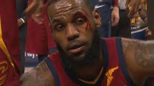 Los angeles — lebron james injured his right ankle during the los angeles lakers' game against the atlanta hawks on saturday, leaving the court in visible frustration after attempting to play through the injury. Lebron James Eye Injury After Getting Elbowed In The Face Cavaliers Vs Pacers Game 6 Youtube