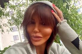 Бывшая супруга футболиста андрея аршавина сделала ринопластику: Bolezn Pokromsala Byvshaya Zhena Andreya Arshavina Rasska Golbis