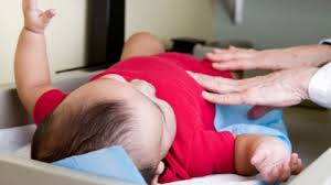 Congenital Diastesis Rectus Abdominis Embodia