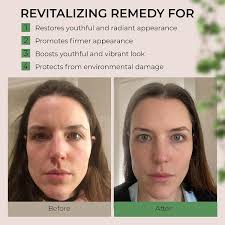 Rejuvenating and Anti-Aging Collagen Face Moisturizer with Stem Cells