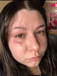 Sharing kind gestures and experiences as stroke survivors